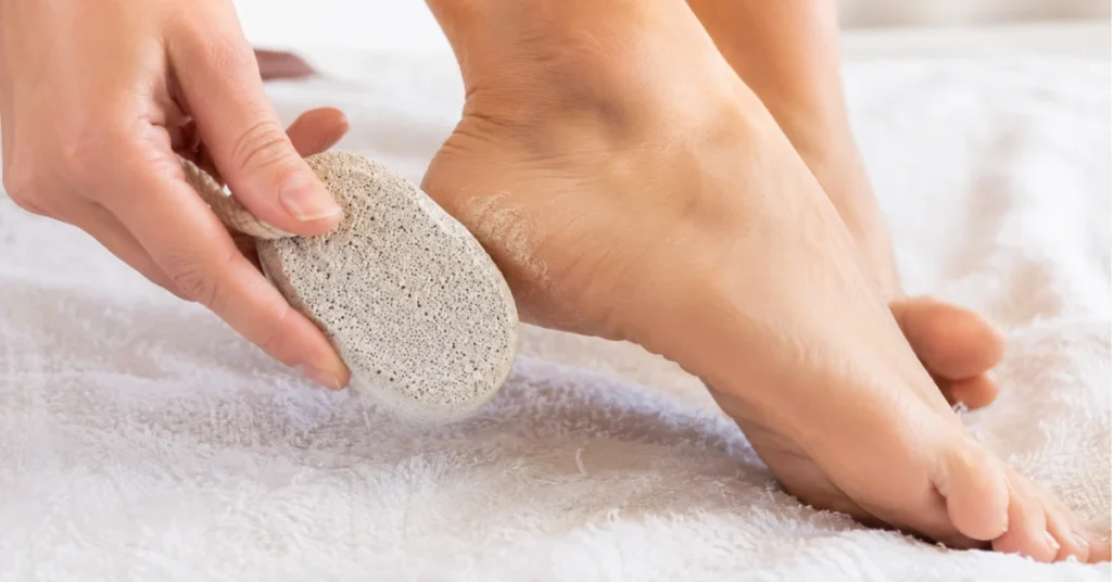 how to remove thick dead skin from feet home remedy